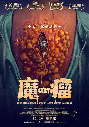 囊肿海报